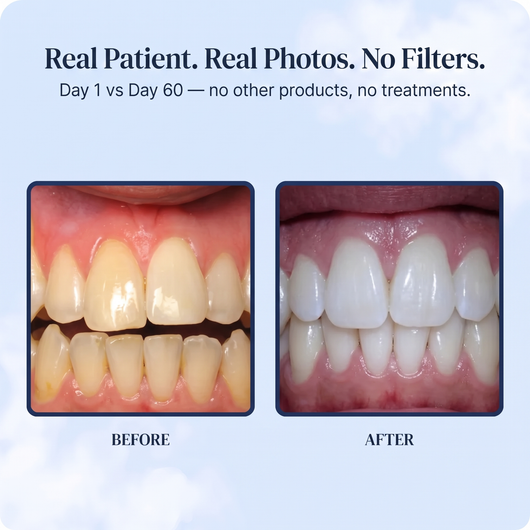JOAME Red Light Toothbrush